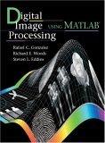 Image of Digital Image Processing Using Matlab
