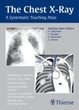 Cover of Chest X-ray Trainer