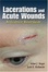 Cover of "Lacerations and Acute Wounds"