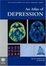 Cover of An Atlas of Depression