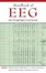 Cover of "Handbook of Eeg Interpretation"